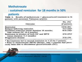56
Treatment of Glucocorticoid-resistant or relapsing Takayasu Arteritis with Methotrexate
Gary S. Hoffman etal. Arthritis & Rheumatism 1994;37(4) : 578-582
Methotrexate
: sustained remission for 18 months in 50%
patients
 