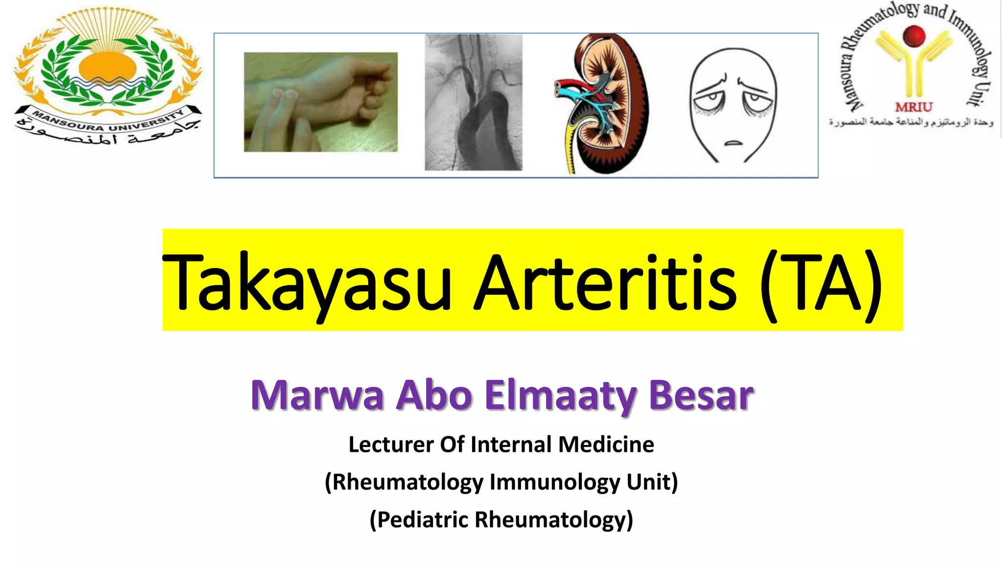 Takayasu arteritis. | PPTX