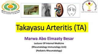 Takayasu Arteritis (TA)
Marwa Abo Elmaaty Besar
Lecturer Of Internal Medicine
(Rheumatology Immunology Unit)
(Pediatric Rheumatology)
 