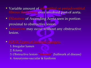 • Variable amount of adventitial or periadventitial
  fibrous thickening over involved part of aorta.
• Dilatation of Ascending Aorta seen in portion
  proximal to obstructive lesion.
• Aneurysm may occur without any obstructive
  lesion.

• FOUR Types of luminal changes:
  1. Irregular lumen
  2. Ectasia
  3. Obstructive lesion-”stenosis” (hallmark of disease)
  4. Aneurysms-saccular & fusiform
 