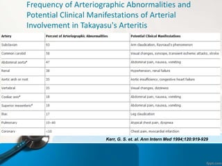 Frequency of Arteriographic Abnormalities and
Potential Clinical Manifestations of Arterial
Involvement in Takayasu's Arte...