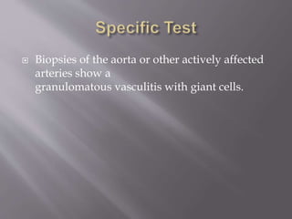  Biopsies of the aorta or other actively affected
arteries show a
granulomatous vasculitis with giant cells.
 