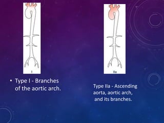 • Type I - Branches
of the aortic arch. Type IIa - Ascending
aorta, aortic arch,
and its branches.
 