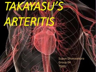 TAKAYASU’S
ARTERITIS
Supun Dhanasekara
Group 04
TSMU
 