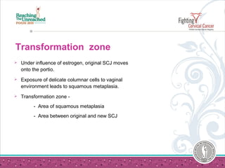 Transformation zone
 Under influence of estrogen, original SCJ moves
onto the portio.
 Exposure of delicate columnar cells to vaginal
environment leads to squamous metaplasia.
 Transformation zone -
- Area of squamous metaplasia
- Area between original and new SCJ
 