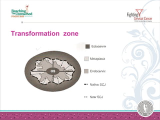 Transformation zone
 
