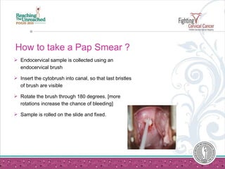 How to take a Pap Smear ? <ul><li>Endocervical sample is collected using an endocervical brush </li></ul><ul><li>Insert th...