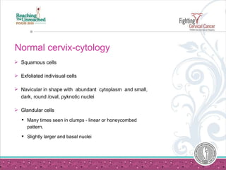 Normal cervix-cytology <ul><li>Squamous cells  </li></ul><ul><li>Exfoliated indivisual cells </li></ul><ul><li>Navicular i...