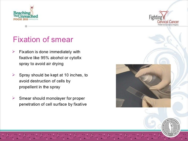 Taking A Pap Smear