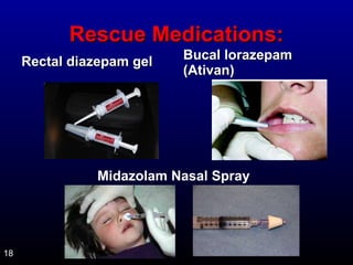 RReessccuuee MMeeddiiccaattiioonnss:: 
RReeccttaall ddiiaazzeeppaamm ggeell BBuuccaall lloorraazzeeppaamm 
((AAttiivvaann) 
18 
Midazolam Nasal Spray 
 