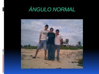 ÁNGULO NORMAL