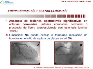 CORONARIOGRAFÍA Y VENTRICULOGRAFÍA
• Ausencia de lesiones obstructivas significativas en
arterias coronarias (arterias cor...