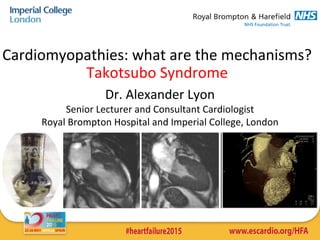 Cardiomyopathies: what are the mechanisms? 
Takotsubo Syndrome
Dr. Alexander Lyon
Senior Lecturer and Consultant Cardiologist
Royal Brompton Hospital and Imperial College, London
 
