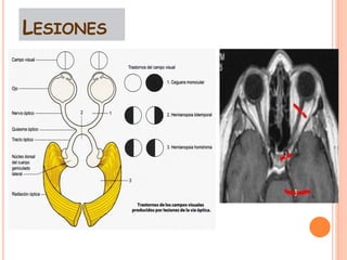Talamo via visual ... | PDF