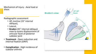 Mechanism of Injury - Axial load or
shear.
Radiographic assessment
• AP, mortise (15° internal
oblique),
• Lateral,
• Broden (45° internal oblique)
view to assess displacement of
articular facet of posterior
subtalar joint
• Treatment - Open reduction and
internal fixation (ORIF)
• Complication - High incidence of
subtalar arthritis
 