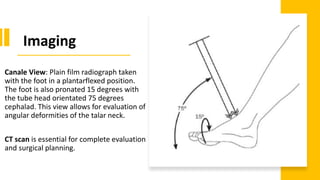 Canale View: Plain film radiograph taken
with the foot in a plantarflexed position.
The foot is also pronated 15 degrees with
the tube head orientated 75 degrees
cephalad. This view allows for evaluation of
angular deformities of the talar neck.
CT scan is essential for complete evaluation
and surgical planning.
Imaging
 