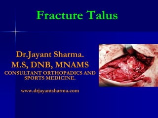 Fracture Talus
Dr.Jayant Sharma.
M.S, DNB, MNAMS
CONSULTANT ORTHOPADICS AND
SPORTS MEDICINE.
www.drjayantsharma.com
 