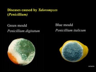 Green mould
Penicillium digitatum
Blue mould
Penicillium italicum
Diseases caused by Taloromyces
(Penicillium)
 