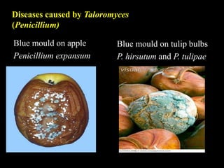 Blue mould on tulip bulbs
P. hirsutum and P. tulipae
Blue mould on apple
Penicillium expansum
Diseases caused by Taloromyces
(Penicillium)
 