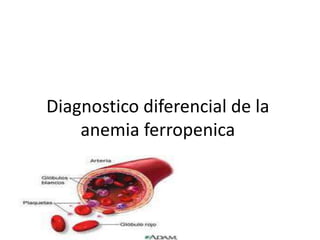 Diagnostico diferencial de la
    anemia ferropenica
 
