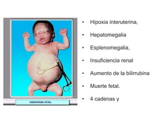 • Hipoxia interuterina,
• Hepatomegalia
• Esplenomegalia,
• Insuficiencia renal
• Aumento de la bilirrubina
• Muerte fetal.
• 4 cadenas γ
 