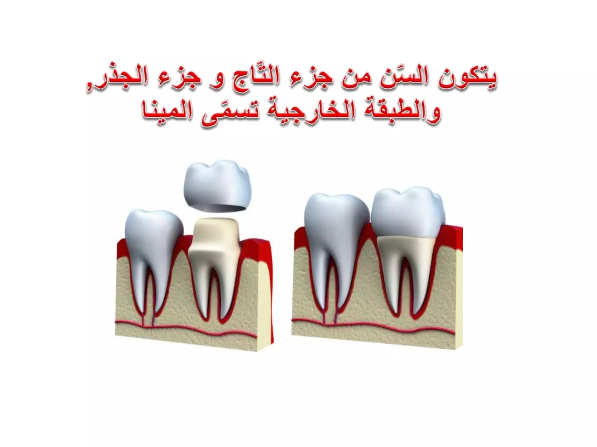 تسوس الأسنان | PPTX