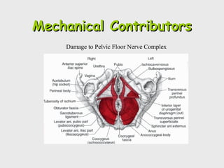 Damage to Pelvic Floor Nerve Complex
Mechanical ContributorsMechanical Contributors
 