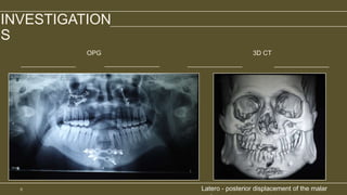 case presentaion.pptx