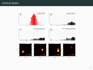 Cortical lesion
-50% 0 +50%
0
20
40
60
80
100
120
140
160
180
200
A
Reference (REF)
(Mean:0.00%, STE: 0.6)
# Cells
-50% 0 +50%
0
20
40
60
80
100
120
140
160
180
200
B
Cortical Lesion (CL)
(Mean:20.07%, STE: 2.9)
# Cells
-50% 0 +50%
0
20
40
60
80
100
120
140
160
180
200
C
Center Cortical Lesion (CCL)
(Mean:19.86%, STE: 3.1)
# Cells
-50% 0 +50%
0
20
40
60
80
100
120
140
160
180
200
D
Boundary Cortical Lesion (BCL)
(Mean:19.90%, STE: 2.9)
# Cells
0.0 0.2 0.4 0.6 0.8 1.0
(mm)
0.0
0.2
0.4
0.6
0.8
1.0
(mm)
REFsize: 0.024 mm2
0 1
0.0 0.2 0.4 0.6 0.8 1.0
(mm)
0.0
0.2
0.4
0.6
0.8
1.0
(mm)
CLsize: 0.027 mm2
0 1
0.0 0.2 0.4 0.6 0.8 1.0
(mm)
0.0
0.2
0.4
0.6
0.8
1.0
(mm)
CCLsize: 0.046 mm2
0 1
0.0 0.2 0.4 0.6 0.8 1.0
(mm)
0.0
0.2
0.4
0.6
0.8
1.0
(mm)
BCLsize: 0.016 mm2
0 1
78
 