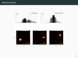 Sensory lesion
-50% 0 +50%
0
20
40
60
80
100
120
140
160
180
200
B
Skin Lesion (SL)
(Mean:20.84%, STE: 3.9)
# Cells
-50% 0 +50%
0
20
40
60
80
100
120
140
160
180
200
C
Center Skin Lesion (CSL)
(Mean:20.79%, STE: 3.0)
# Cells
0.0 0.2 0.4 0.6 0.8 1.0
(mm)
0.0
0.2
0.4
0.6
0.8
1.0
(mm)
REFsize: 0.024 mm2
0 1
0.0 0.2 0.4 0.6 0.8 1.0
(mm)
0.0
0.2
0.4
0.6
0.8
1.0(mm) SLsize: 0.016 mm2
0 1
0.0 0.2 0.4 0.6 0.8 1.0
(mm)
0.0
0.2
0.4
0.6
0.8
1.0
(mm)
CSLsize: 0.022 mm2
0 1
80
 