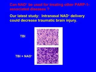 Can NAD +  be used for treating other PARP-1-associated diseases ?  Our latest study:  Intranasal NAD +  delivery could decrease traumatic brain injury. TBI TBI + NAD + 