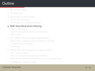 Outline
1. Me in one slide
2. Introduction
3. Deﬁnition of robustness
Noise and robustness
Robustness for image processing
4. MM: Smoothed shock ﬁltering
Test of robustness
Improvement of machine learning tasks
Discussion
5. DG: Robust Reeb graph computations
Reeb graph computations by skeleton extraction
Experimental evaluation
Discussion
6. MM & DG for biomedical image analysis
HCC segmentation
Hepatic vascular network segmentation
Robustness with shape variability for liver segmentation
7. Conclusion, future works
Antoine Vacavant 14 / 55
 