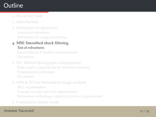Outline
1. Me in one slide
2. Introduction
3. Deﬁnition of robustness
Noise and robustness
Robustness for image processing
4. MM: Smoothed shock ﬁltering
Test of robustness
Improvement of machine learning tasks
Discussion
5. DG: Robust Reeb graph computations
Reeb graph computations by skeleton extraction
Experimental evaluation
Discussion
6. MM & DG for biomedical image analysis
HCC segmentation
Hepatic vascular network segmentation
Robustness with shape variability for liver segmentation
7. Conclusion, future works
Antoine Vacavant 17 / 55
 