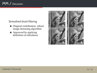 MM / Discussion
Smoothed shock filtering
Original contribution: robust
image denoising algorithm
Approved by applying
deﬁnition of robustness
Antoine Vacavant 24 / 55
 