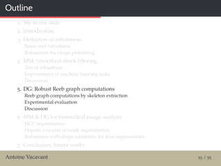 Outline
1. Me in one slide
2. Introduction
3. Deﬁnition of robustness
Noise and robustness
Robustness for image processing
4. MM: Smoothed shock ﬁltering
Test of robustness
Improvement of machine learning tasks
Discussion
5. DG: Robust Reeb graph computations
Reeb graph computations by skeleton extraction
Experimental evaluation
Discussion
6. MM & DG for biomedical image analysis
HCC segmentation
Hepatic vascular network segmentation
Robustness with shape variability for liver segmentation
7. Conclusion, future works
Antoine Vacavant 25 / 55
 