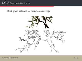DG / Experimental evaluation
Reeb graph obtained for noisy vascular image
Antoine Vacavant 36 / 55
 