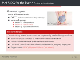 MM & DG for the liver / Context and motivation
Our research group
Inside IGT research axis
CaVITI (Cardio-Vascular Interventional Therapy and Imaging)
3 research groups
Theme 1: Endoprothesis
Theme 2: Embolization
Theme 3: Myocardial function
Research targets
Quantitatively assess hepatic tumoral response by medical image analysis
Innovative tools devoted to tumoral tissue quantiﬁcation
Personalized numerical simulation of treatments
Link with clinical activities: chemo-embolization, surgery, biopsy, etc.
Target cancer: HCC (Hepato-Cellular Carcinoma)
Antoine Vacavant 42 / 55
 