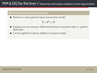 MM & DG for the liver / Robustness with shape variability for liver segmentation
Novel measurement of robustness
Based on a more general input uncertainty model
Y Y0
δY
Suppose we can measure diﬀerence between uncertain data vs. perfect
ideal data
Can be applied to classic additive Gaussian model
Antoine Vacavant 50 / 55
 