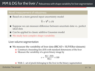 MM & DG for the liver / Robustness with shape variability for liver segmentation
Novel measurement of robustness
Based on a more general input uncertainty model
Y Y0
δY
Suppose we can measure diﬀerence between uncertain data vs. perfect
ideal data
Can be applied to classic additive Gaussian model
We study here complex shape variability
Liver volume segmentation
We measure the variability of liver data (IRCAD + SLIVER07 datasets)
Construct a bounding box (BB) with standard dimensions of the liver
Measure the variability of a given binary image by
σ
#(L  BB)
#(L)
× 100
With L: set of pixels belonging to the liver in the binary segmentation
Antoine Vacavant 50 / 55
 