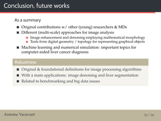 Conclusion, future works
As a summary
Original contributions w/ other (young) researchers & MDs
Diﬀerent (multi-scale) approaches for image analysis
Image enhancement and denoising employing mathematical morphology
Tools from digital geometry / topology for representing graphical objects
Machine learning and numerical simulation: important topics for
computer-aided liver cancer diagnosis
Robustness
Original & foundational deﬁnitions for image processing algorithms
With 2 main applications: image denoising and liver segmentation
Related to benchmarking and big data issues
Antoine Vacavant 53 / 55
 