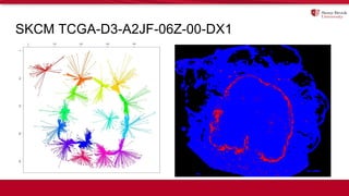 SKCM TCGA-D3-A2JF-06Z-00-DX1
 