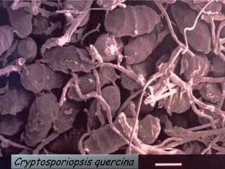 Cryptosporiopsis quercina
 
