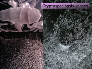 Cryptosporiopsis spores
 