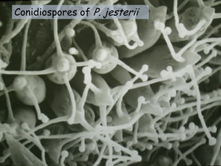Conidiospores of P. jesterii
 