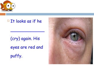    It looks as if he

    _____________

    (cry) again. His

    eyes are red and

    puffy.
 