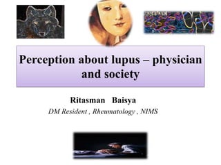 Perception about lupus – physician
and society
Ritasman Baisya
DM Resident , Rheumatology , NIMS
 