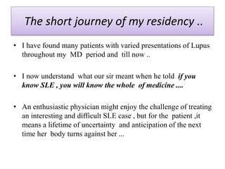 talking lupus.pptx