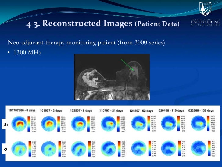 Microwave Imaging for Breast Cancer Detection and Therapy Monitoring
