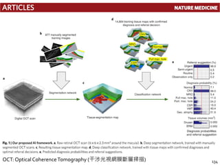 134OCT: Optical CoherenceTomography (干涉光視網膜斷層掃描)
 
