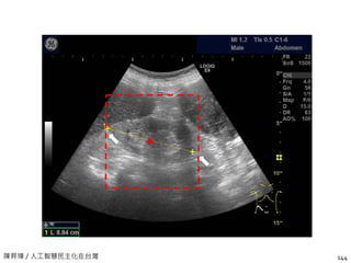 陳昇瑋 / 人工智慧民主化在台灣 144
 